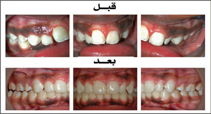 الحالة (21)